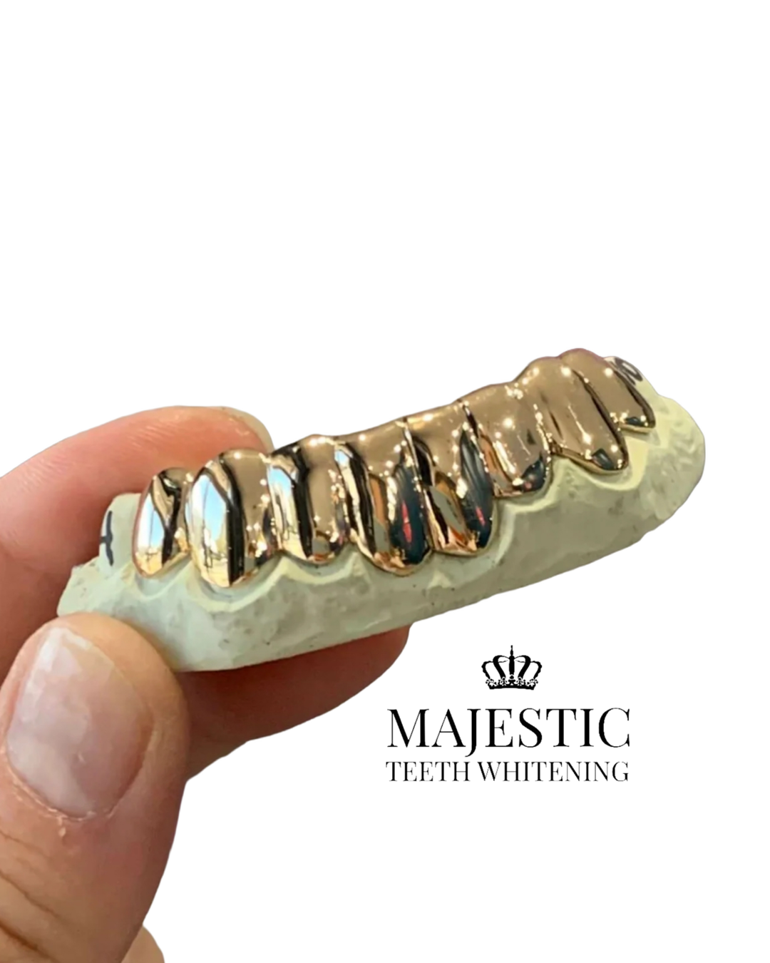 Solid Gold Grillz- Australia - Main Image