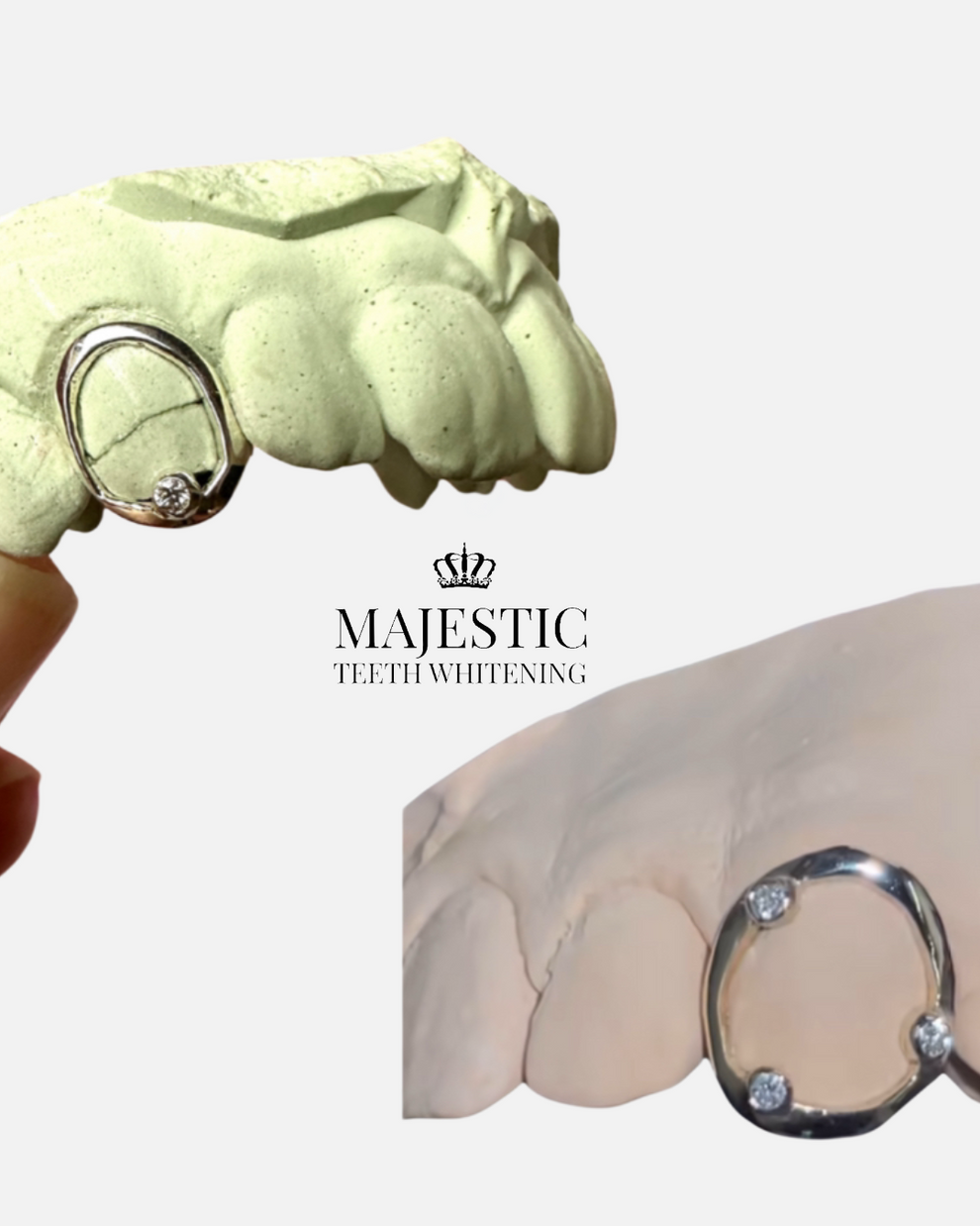 Single Window Cap with Stone- Grillz – Majestic Teeth Whitening